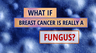 What If Breast Cancer Is Really A Fungus?