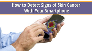 How to Detect Signs of Skin Cancer With Your Smartphone