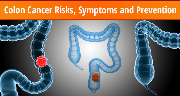 Colon Cancer Risks, Symptoms and Prevention