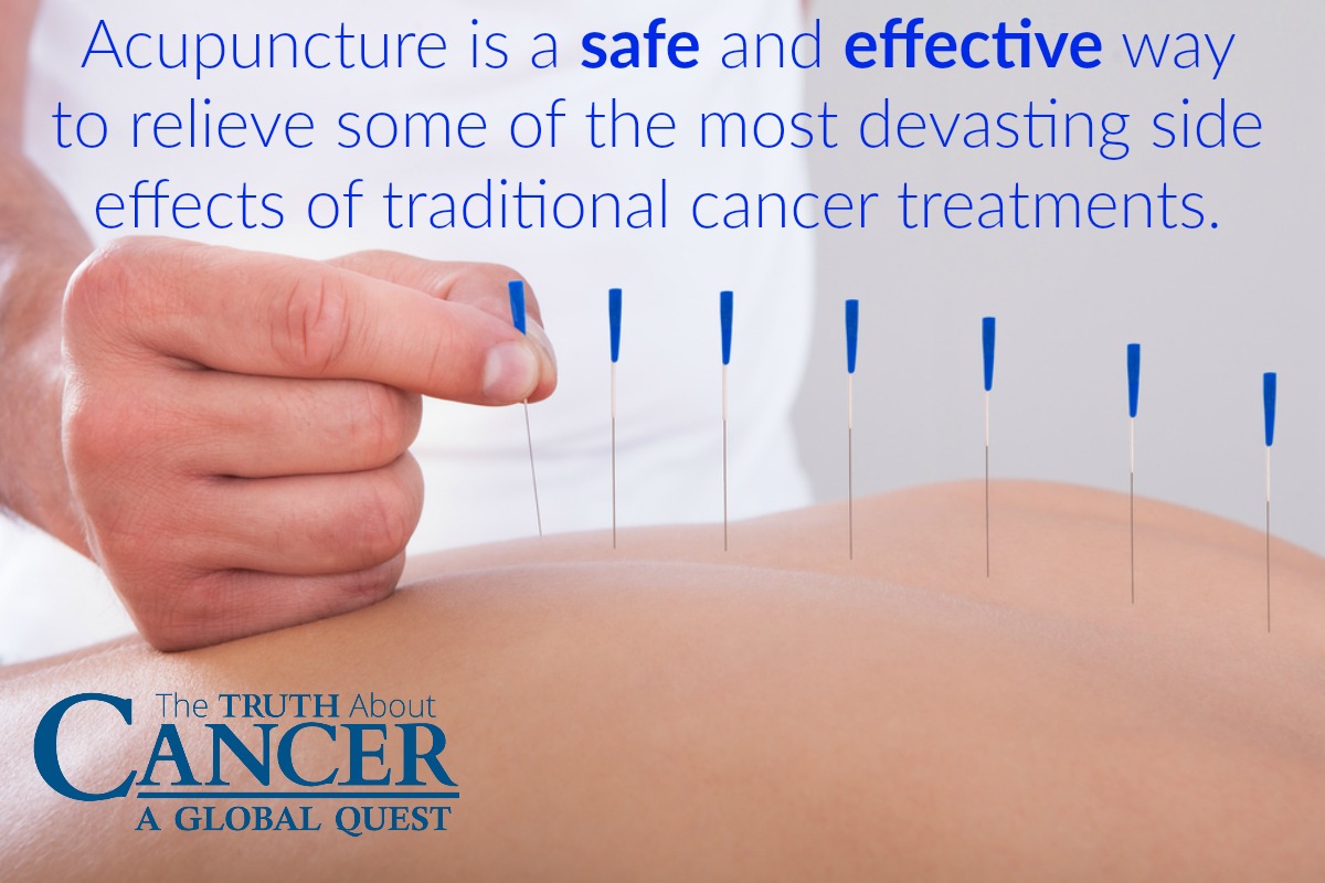 Acupuncture is a safe and effective treatment for cancer patients.