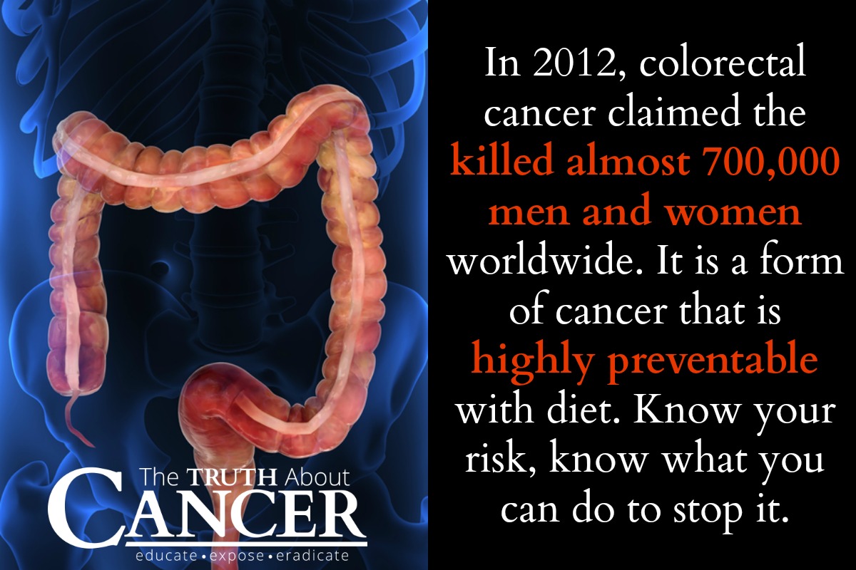 You need to know the facts about colorectal cancer