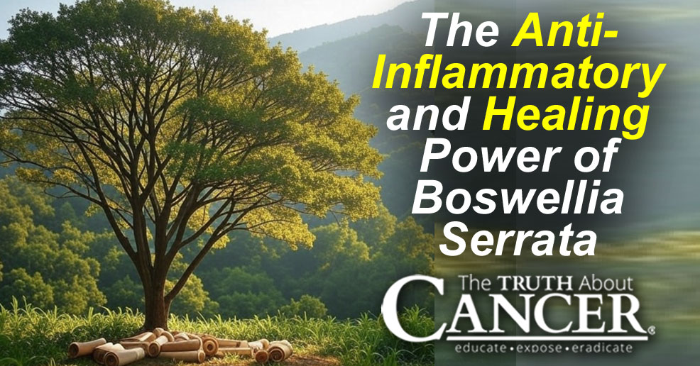 The Anti-Inflammatory and Healing Power of Boswellia Serrata The Anti-Inflammatory and Healing Power of Boswellia Serrata