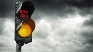 7 Rarely Discussed Early Signs of Breast Cancer