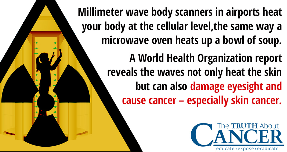 Millimeter-wave-body-scanner