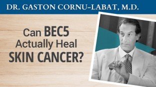 Can BEC5 Actually Heal Skin Cancer? (video)