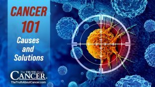 Cancer 101 | Causes and Solutions
