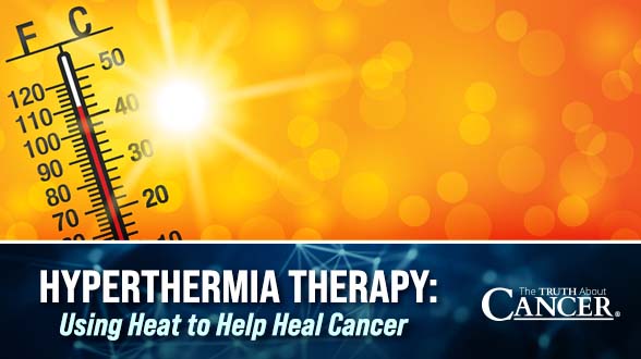 Hyperthermia Therapy: Using Heat to Help Heal Cancer