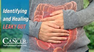 Identifying and Healing Leaky Gut