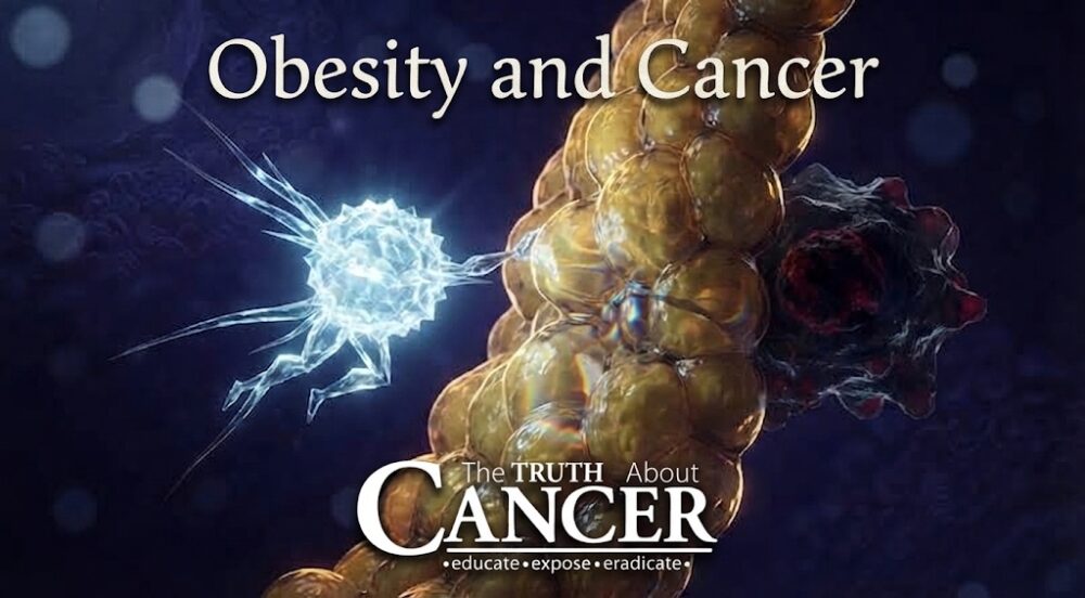 Obesity and Cancer: New Research Discovers Immunity Link Obesity and Cancer: New Research Discovers Immunity Link