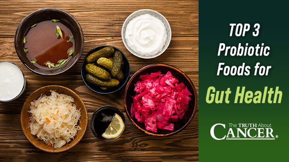 Top 3 Probiotic Foods for Gut Health