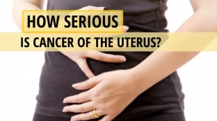 How Serious is Cancer of the Uterus?