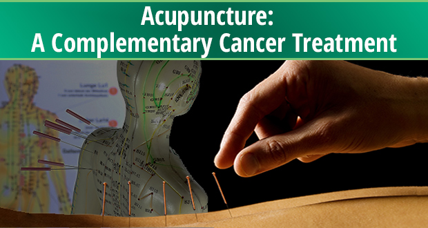 Acupuncture:  A Complementary Cancer Treatment