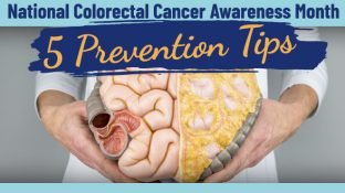 National Colorectal Cancer Awareness Month: 5 Prevention Tips