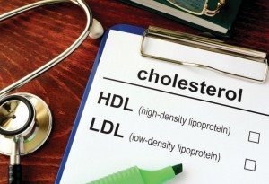 Cholesterol HDL LDL