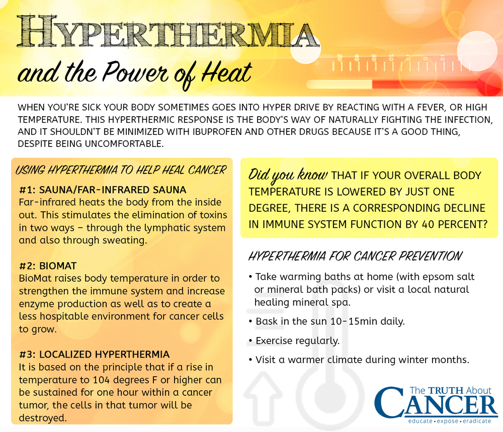 TTAC-book-hyperthermia-treatment-cancer