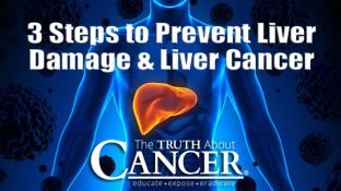 3 Steps to Prevent Liver Damage and Cancer of the Liver
