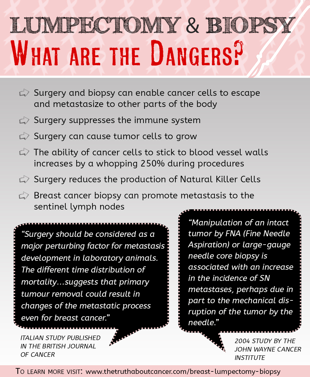 lumpectomy-biopsy-breast-cancer