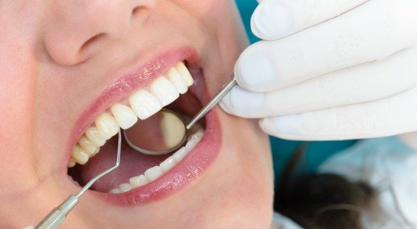 Natural Approaches to Reversing Tooth Decay